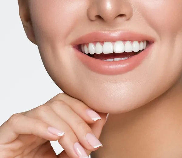 Hollywood Smile